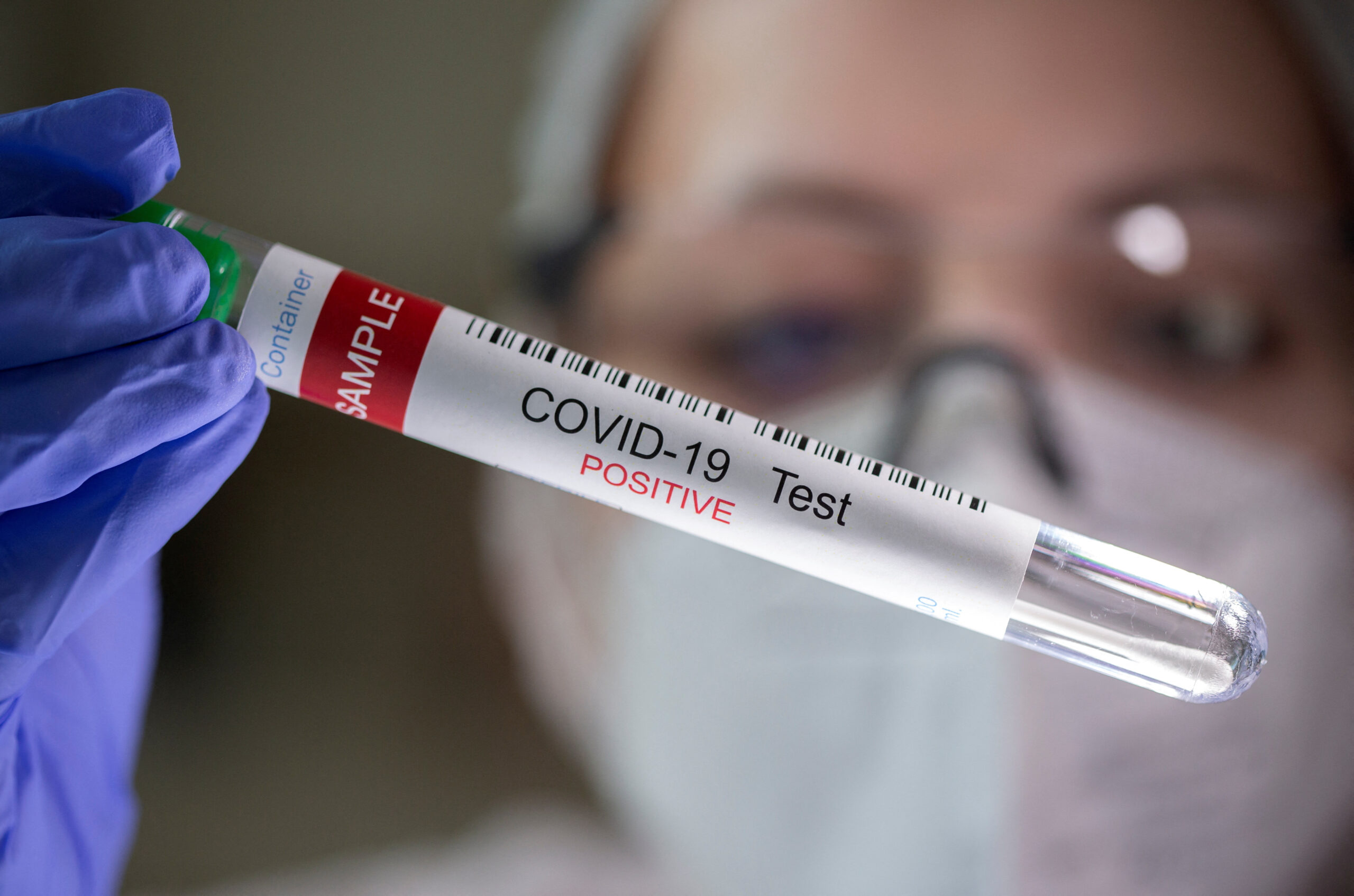 AccessDx Laboratory Reaches 1,500,000 COVID-19 Samples Processed